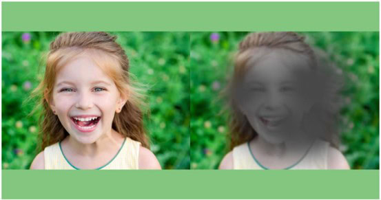 משקפיים לניוון רשתית